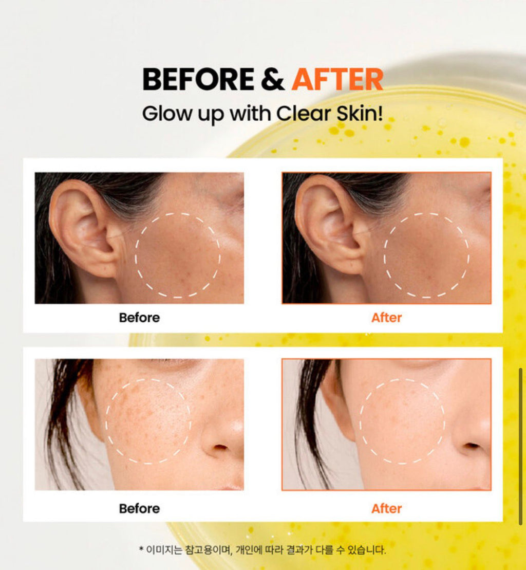 K-SECRET SEOUL 1988 Glow Serum : Niacinamide 15% + Yuja 30ml