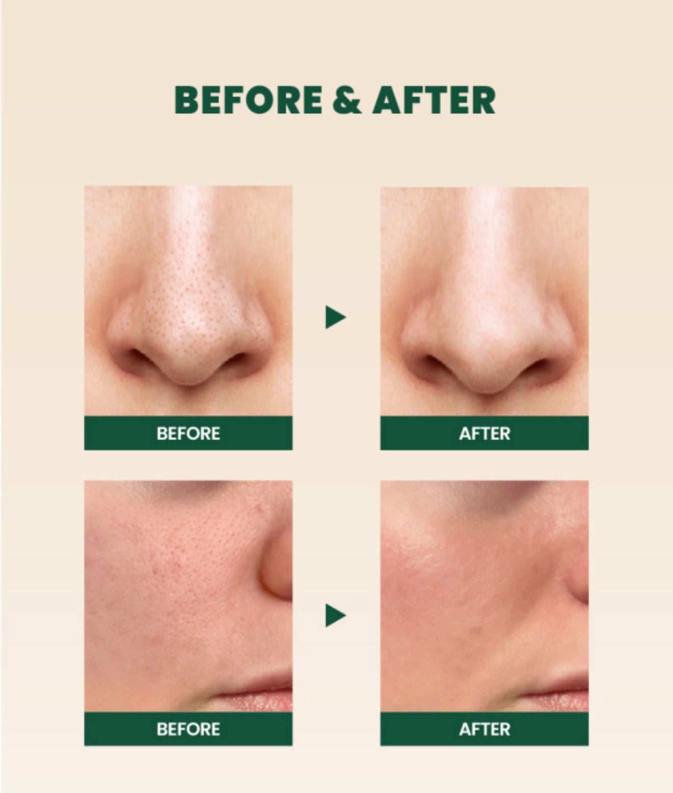 K-SECRET SEOUL 1988 Cleansing Foam : Pine Cica 1% + Probiotics 150ml